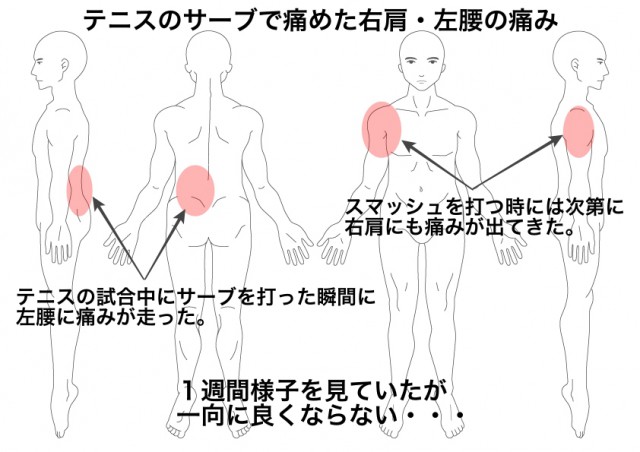 痛み 背中 左側 肩 甲骨 下 の の 肩甲骨付近の背中の痛み、原因は？実は内臓も関係している？