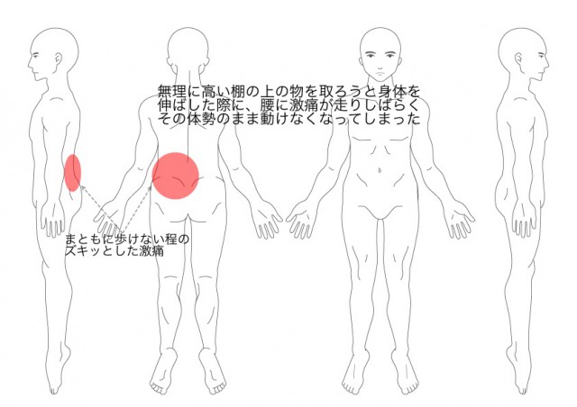 ぎっくり腰（その①）