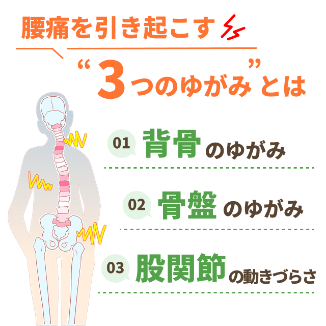 腰痛を引き起こす３つのゆがみとは