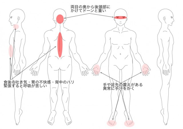 めまい・統合失調症