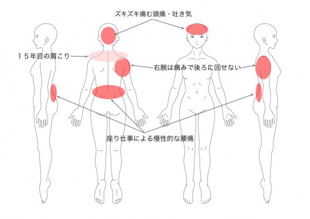 症例　肩こり・頭痛・腰痛（三浦陽子）