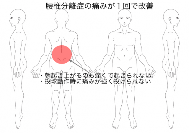 分離症（伊藤くん）