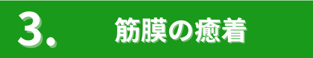 筋膜の癒着